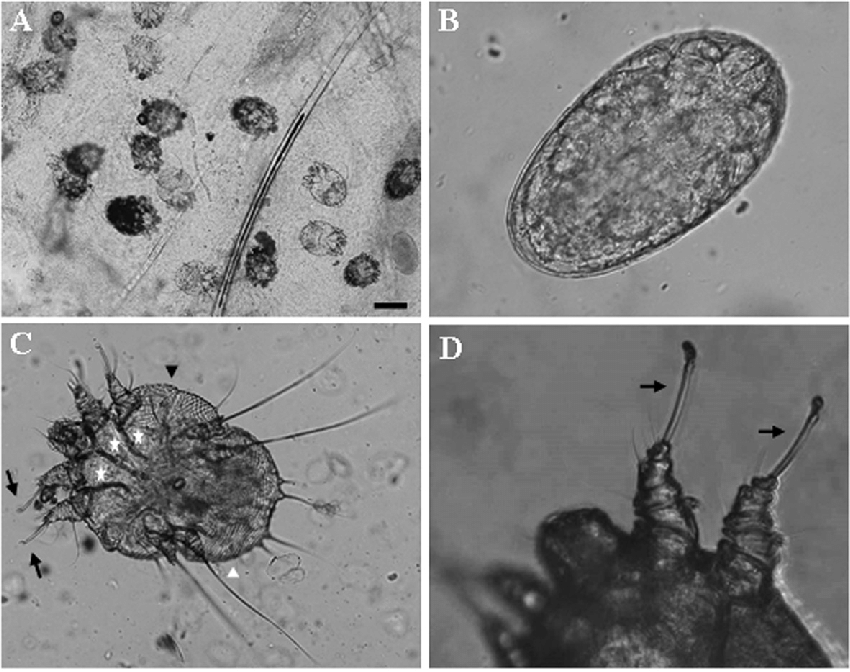 чесоточный клещ и яйца чесоточного клеща